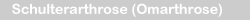 Omarthrose